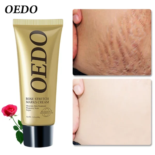 Rose Removes Stretch Mark Cream To Remove Postpartum Obesity Pregnant Women Repair Anti-Aging Anti-Winkles Firming Body Cream - Image 2