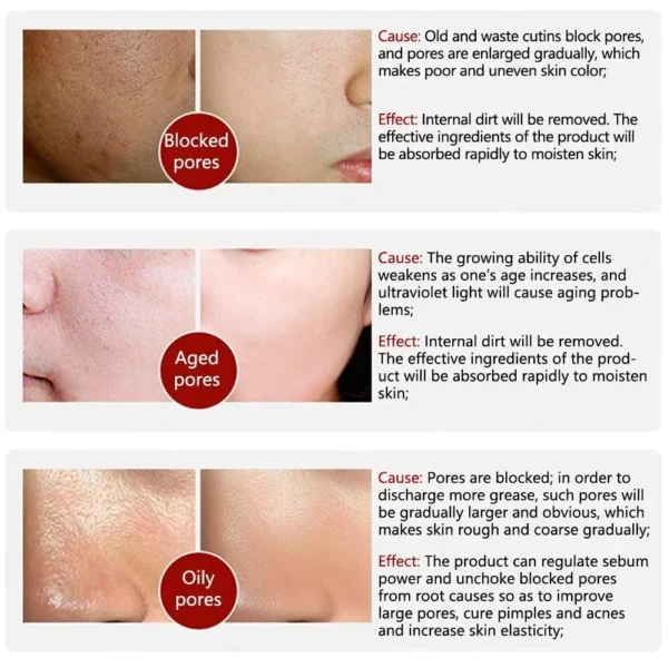 Skin Texture | Pore Refining Resurfacing, Brightening Facial Serum with Retinol and Niacinamide Non-Comedogenic - Image 5