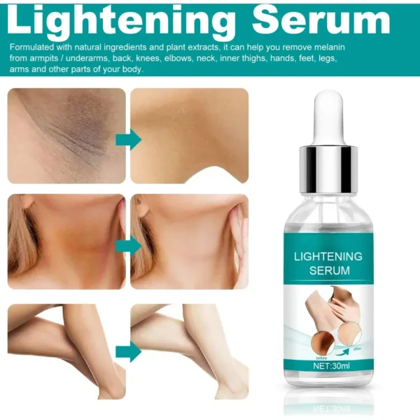 Skin Whitening Serum Private Parts Underarm Bleaching Serum Whiten Butt Knee Brighten Inner Thigh Arm Body Remove Dark Melanin - Image 2