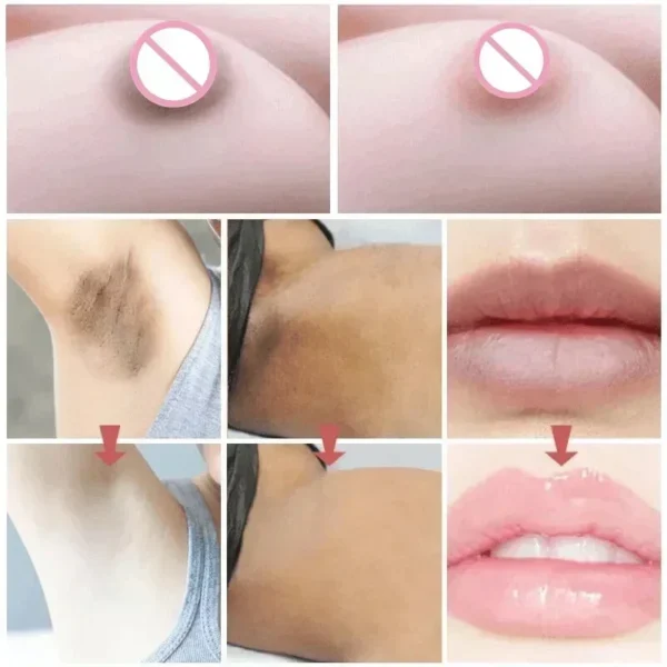 Skin Whitening Serum Private Parts Underarm Bleaching Serum Whiten Butt Knee Brighten Inner Thigh Arm Body Remove Dark Melanin - Image 5