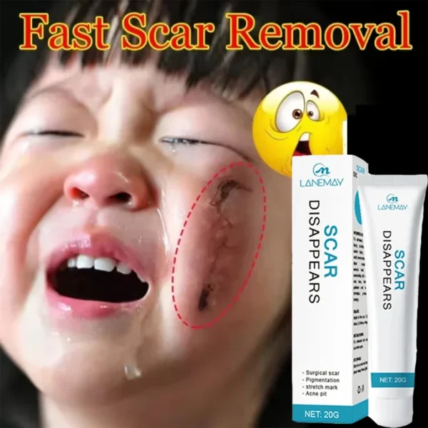 Scar Removal Cream Keloid Burn Surgical Scar Remove Treatment Stretch Marks Smoothing Whitening Pigmentation Body Care Ointment