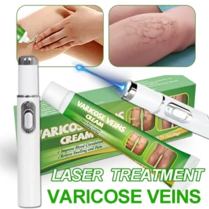 Laser Treatment for Varicose Veins Spider Legs Phlebitis Vasculitis Relieve Leg Pain Improve Blood Circulation
